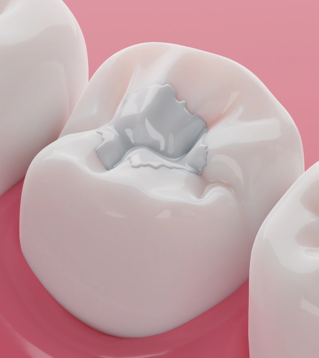 Treating Cavities Before They Become Bigger Problems