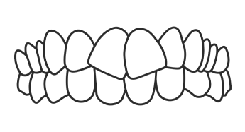 Crowding