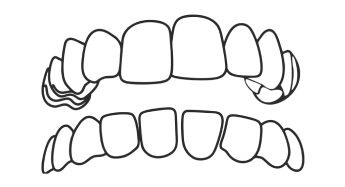 Spacing and Gaps
